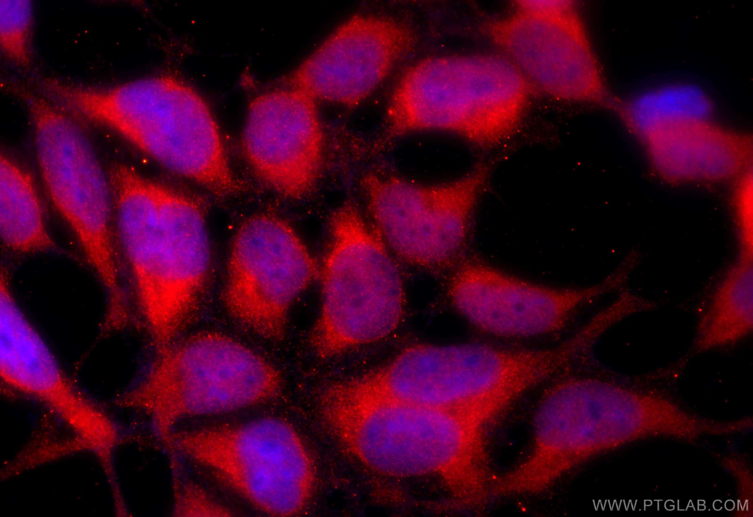 IF Staining of HEK-293 using 21461-1-AP