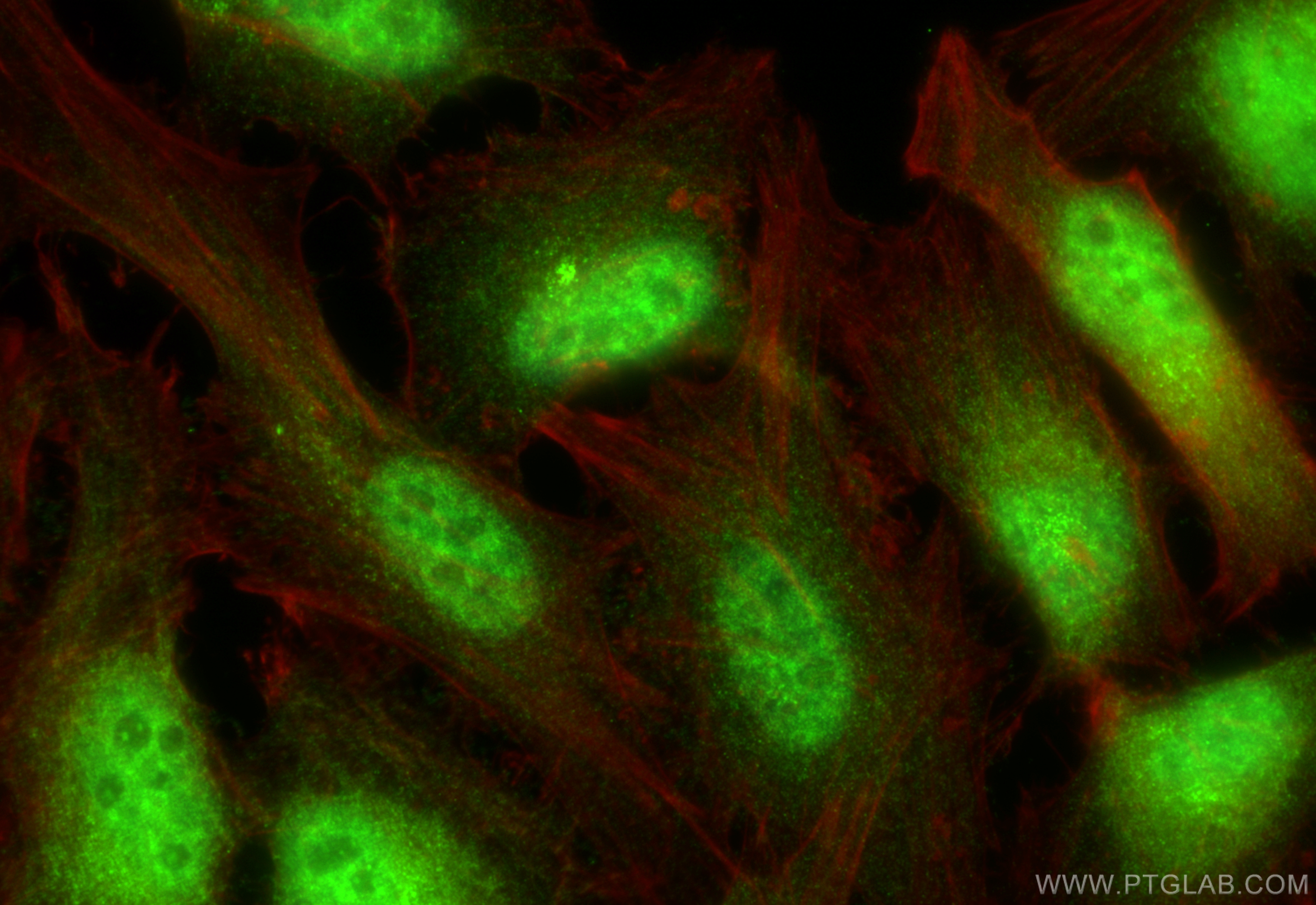IF Staining of HeLa using 21357-1-AP