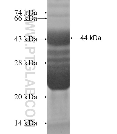 C21orf67 fusion protein Ag19540 SDS-PAGE C21orf67 fusion protein Ag19540 SDS-PAGE