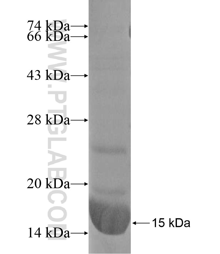 C21orf84 fusion protein Ag17200 SDS-PAGE C21orf84 fusion protein Ag17200 SDS-PAGE