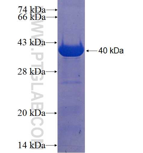 C21orf91 fusion protein Ag22599 SDS-PAGE C21orf91 fusion protein Ag22599 SDS-PAGE