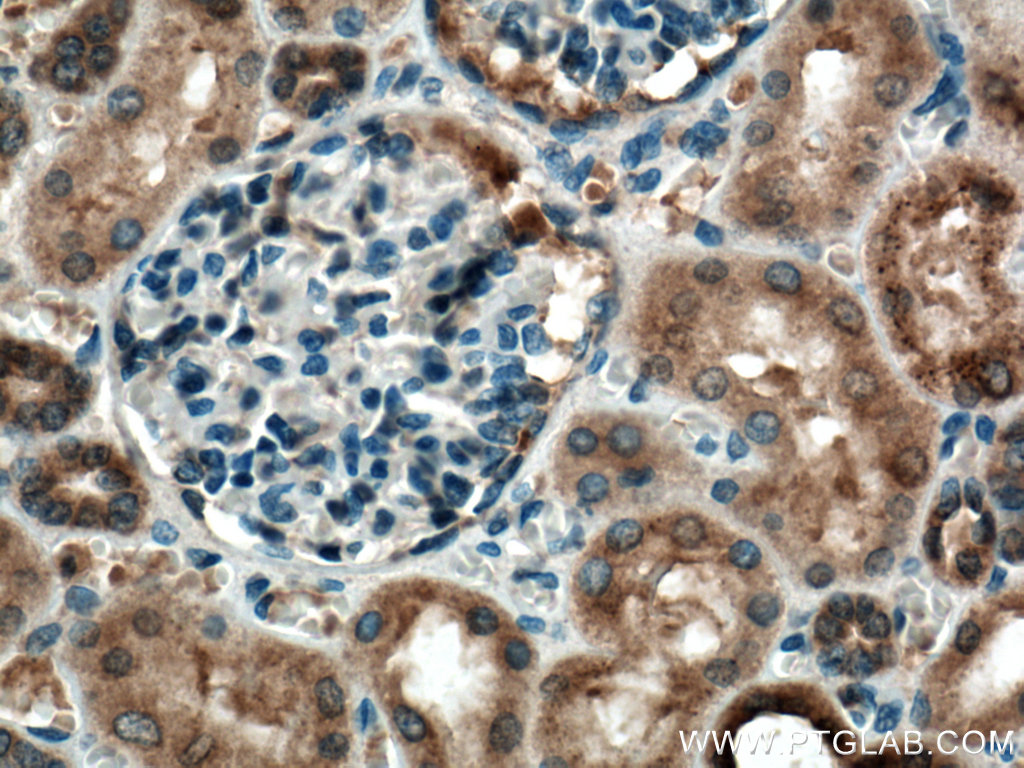 IHC staining of human kidney using 27846-1-AP