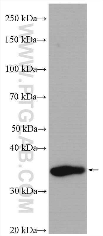 WB analysis of mouse kidney using 27846-1-AP