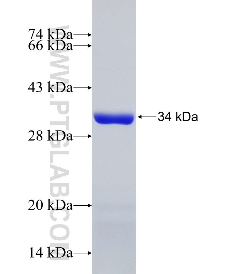 C22orf25 fusion protein Ag27127 SDS-PAGE