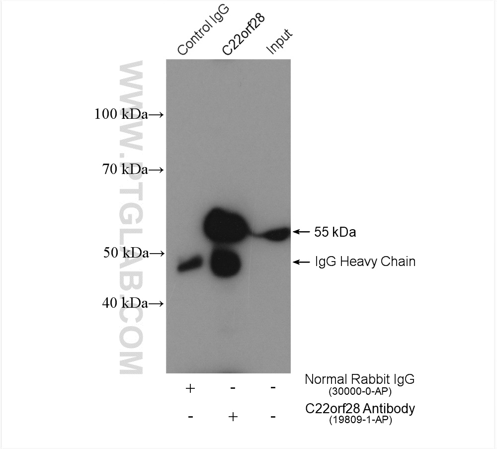 IP experiment of HeLa using 19809-1-AP