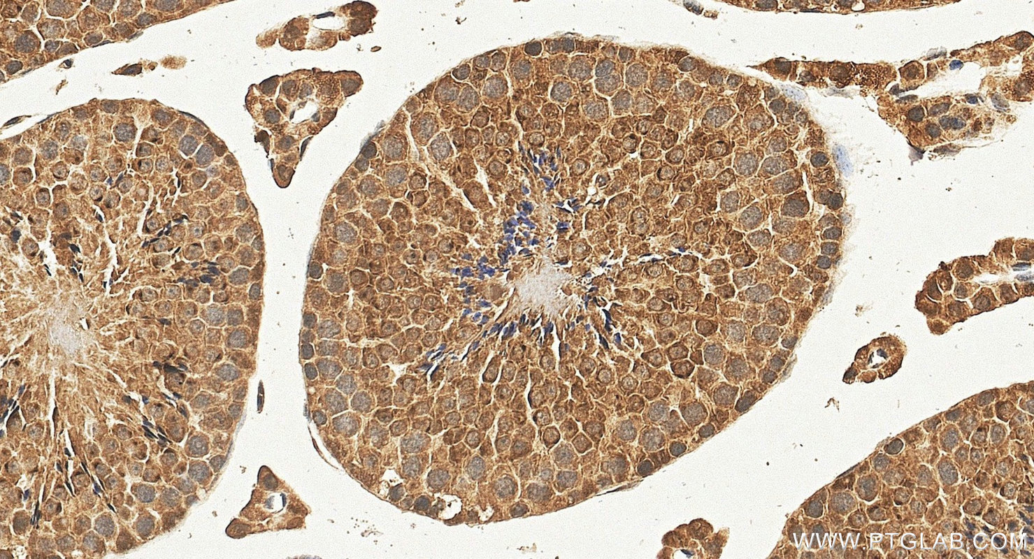 IHC staining of mouse testis using 26577-1-AP IHC staining of mouse testis using 26577-1-AP