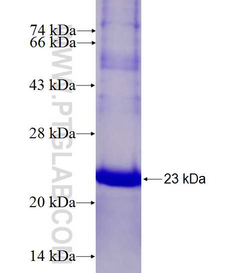 C2orf34 fusion protein Ag27568 SDS-PAGE C2orf34 fusion protein Ag27568 SDS-PAGE