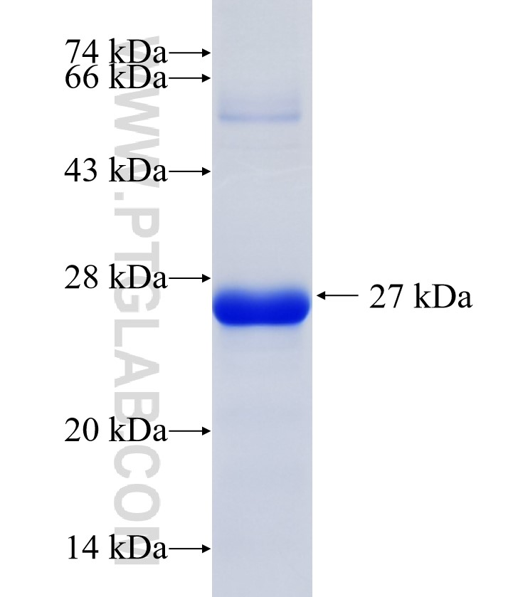 C2orf43 fusion protein Ag36747 SDS-PAGE C2orf43 fusion protein Ag36747 SDS-PAGE