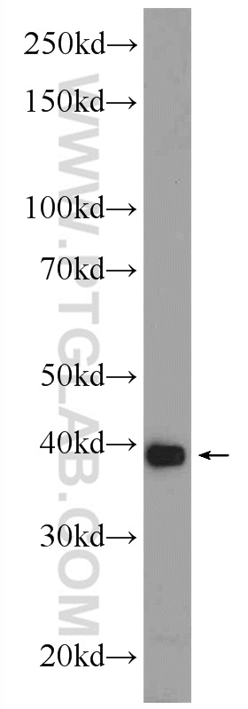 WB analysis of mouse kidney using 24930-1-AP