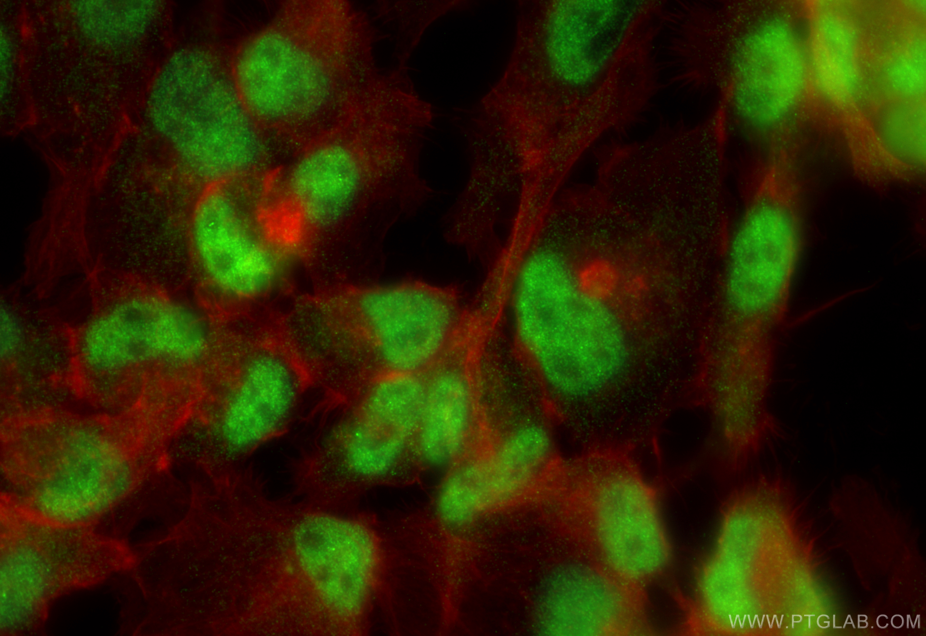 IF Staining of A431 using 18272-1-AP