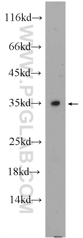 WB analysis of mouse testis using 25464-1-AP