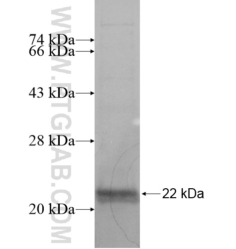 C2orf58 fusion protein Ag14893 SDS-PAGE C2orf58 fusion protein Ag14893 SDS-PAGE