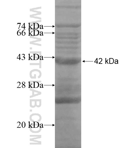 C2orf58 fusion protein Ag14908 SDS-PAGE C2orf58 fusion protein Ag14908 SDS-PAGE