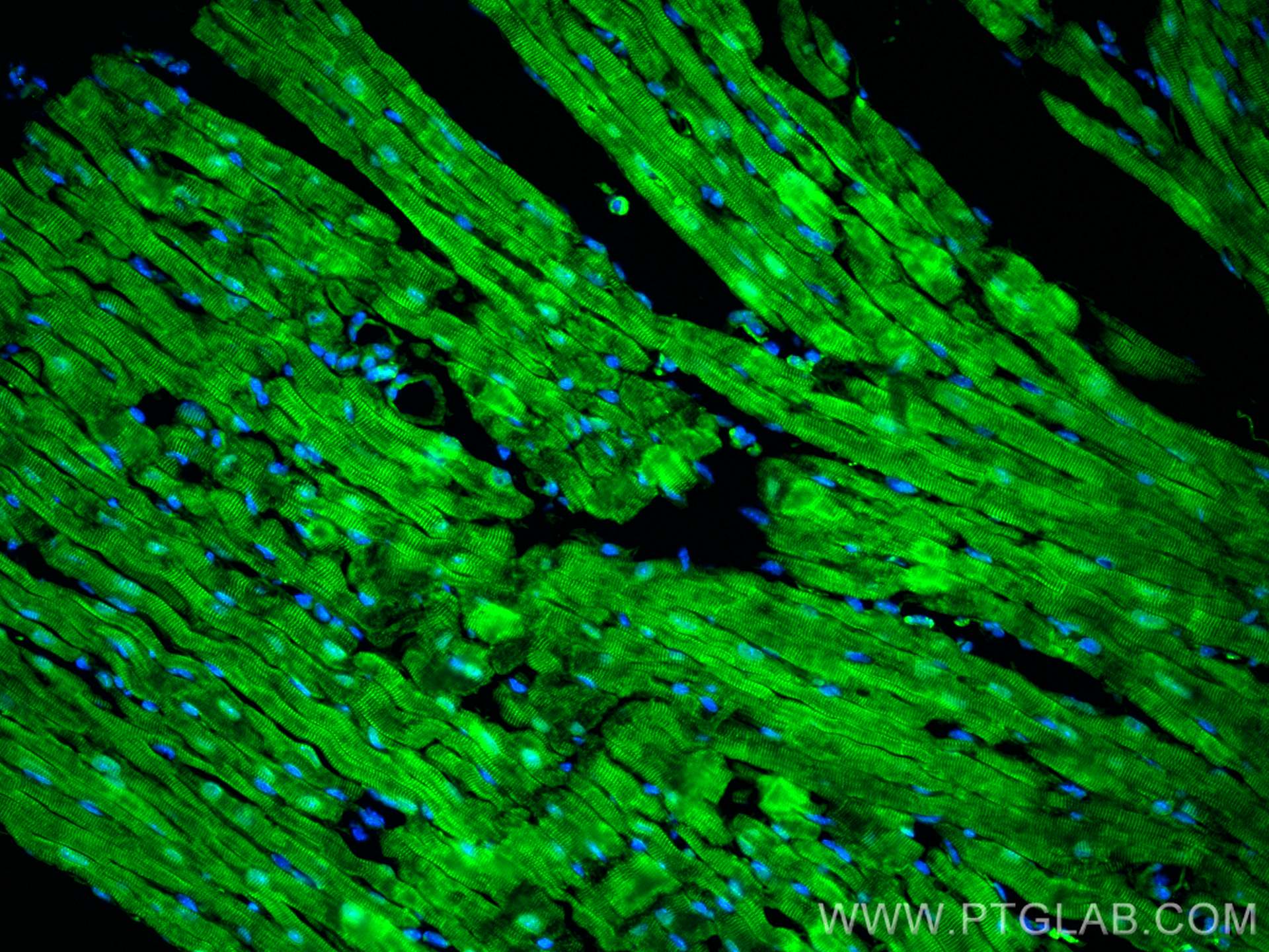 IF Staining of mouse heart using 24751-1-AP (same clone as 24751-1-PBS)