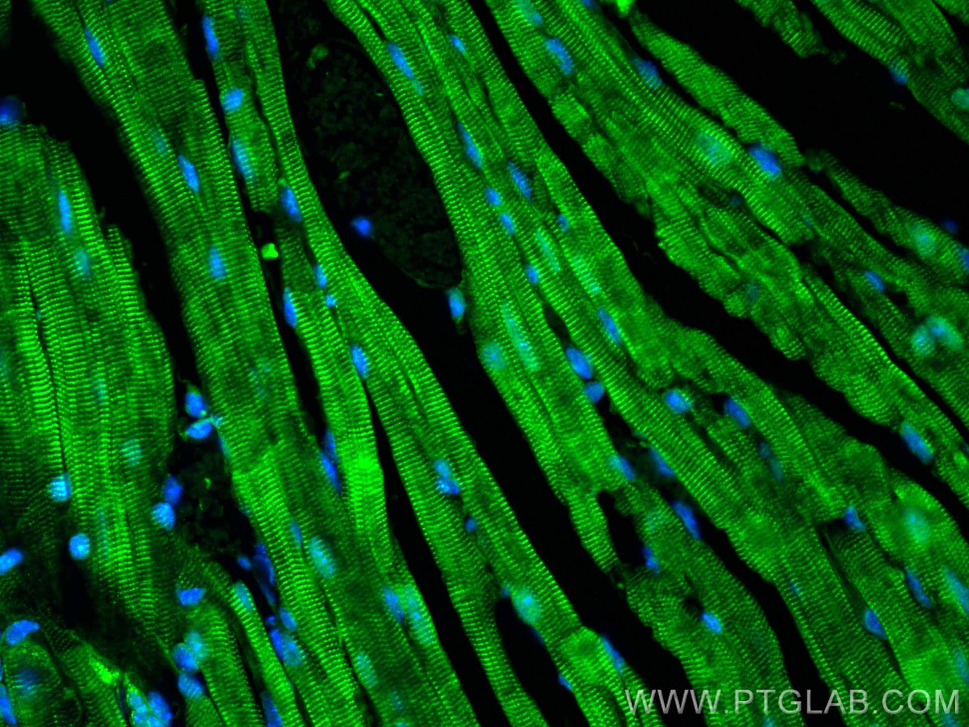 IF Staining of mouse heart using 24751-1-AP (same clone as 24751-1-PBS)