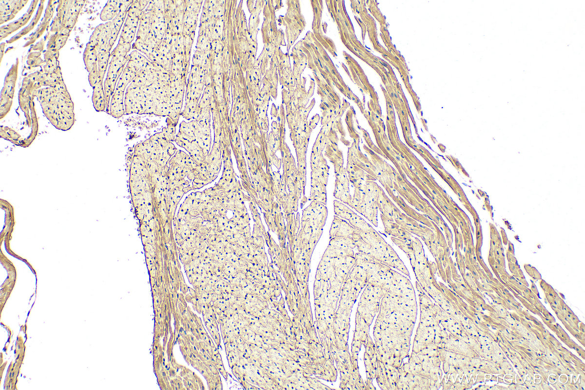 IHC staining of mouse heart using 24751-1-AP (same clone as 24751-1-PBS)