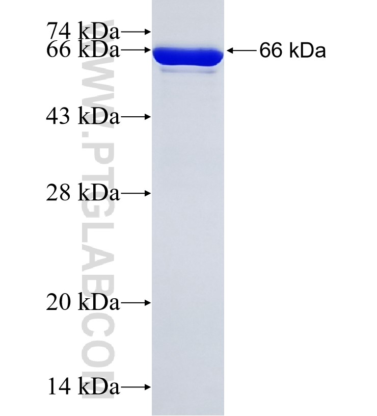 C2orf62 fusion protein Ag20587 SDS-PAGE C2orf62 fusion protein Ag20587 SDS-PAGE