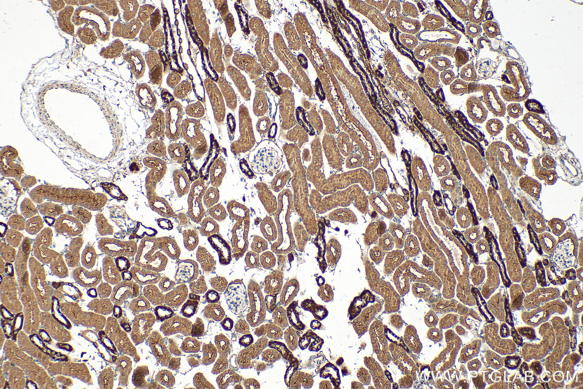 IHC staining of mouse kidney using 32100-1-AP (same clone as 32100-1-PBS)