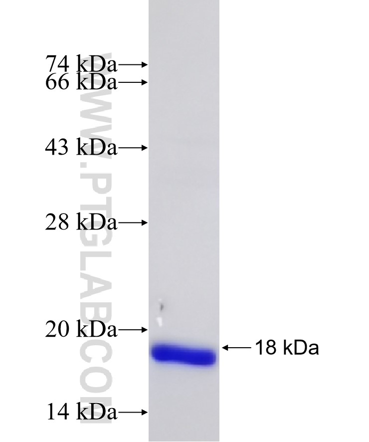C2orf79 fusion protein Ag33214 SDS-PAGE C2orf79 fusion protein Ag33214 SDS-PAGE
