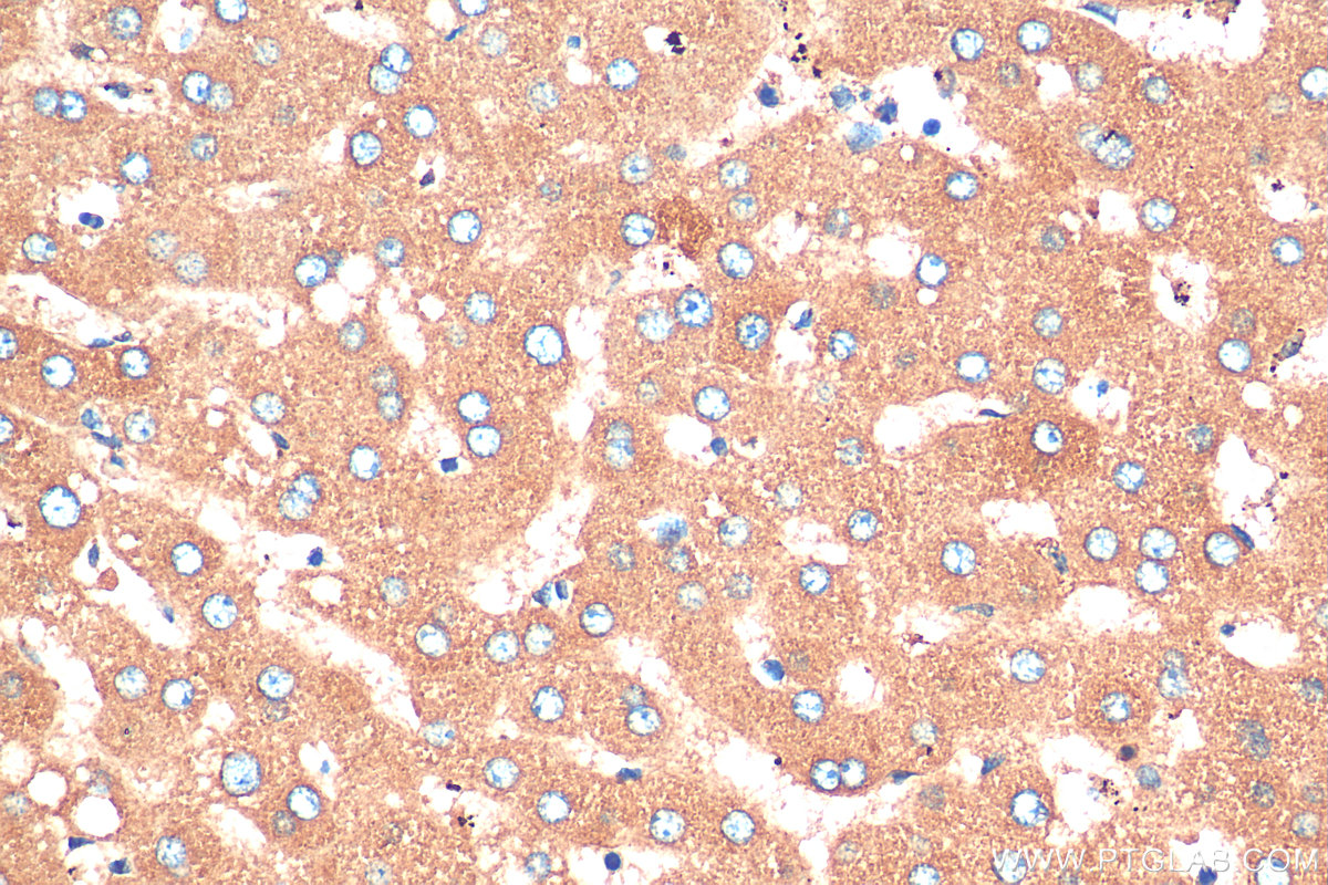 IHC staining of human liver using 21337-1-AP