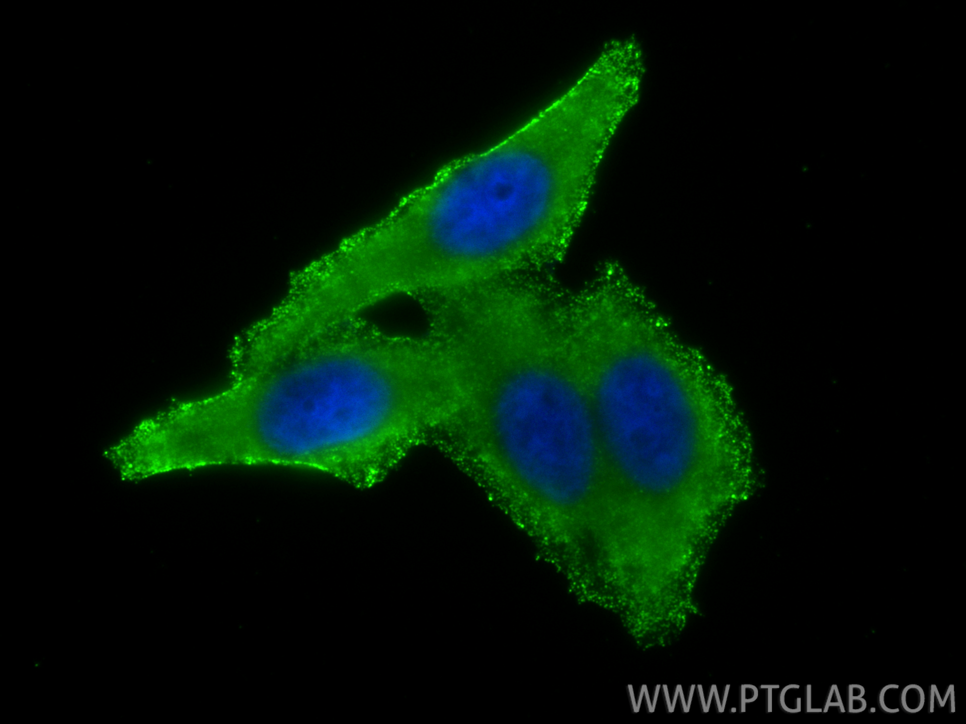 IF Staining of HepG2 using 66157-1-Ig (same clone as 66157-1-PBS) IF Staining of HepG2 using 66157-1-Ig (same clone as 66157-1-PBS)