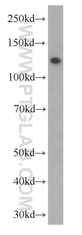 C3/C3b/C3c Monoclonal antibody