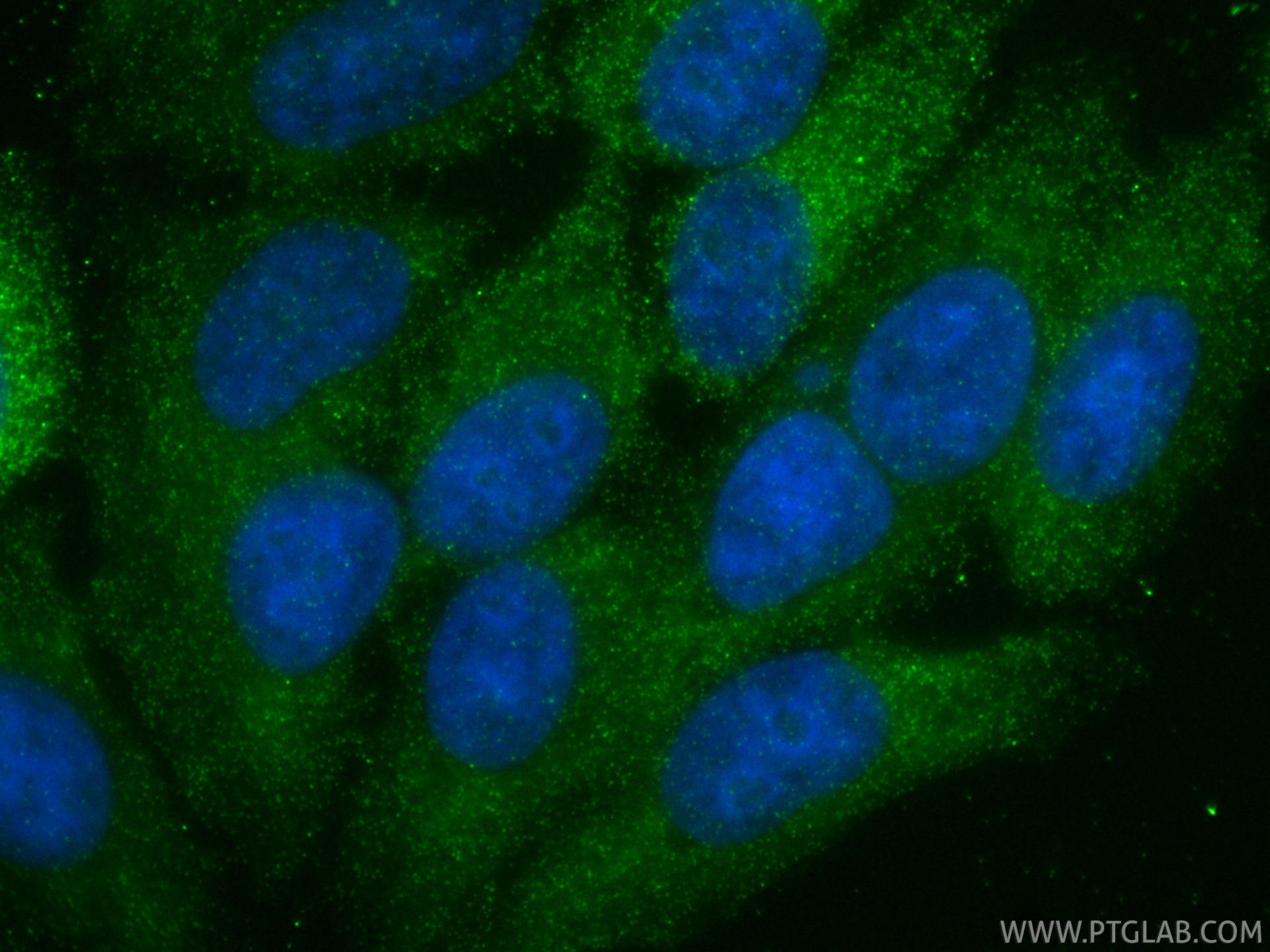 IF Staining of HepG2 using 87386-1-RR IF Staining of HepG2 using 87386-1-RR