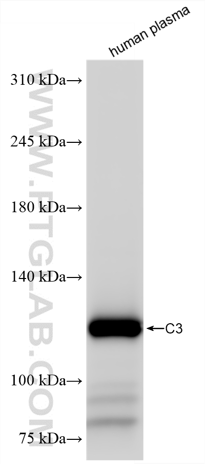WB analysis of human plasma using 87386-1-RR (same clone as 87386-1-PBS)
