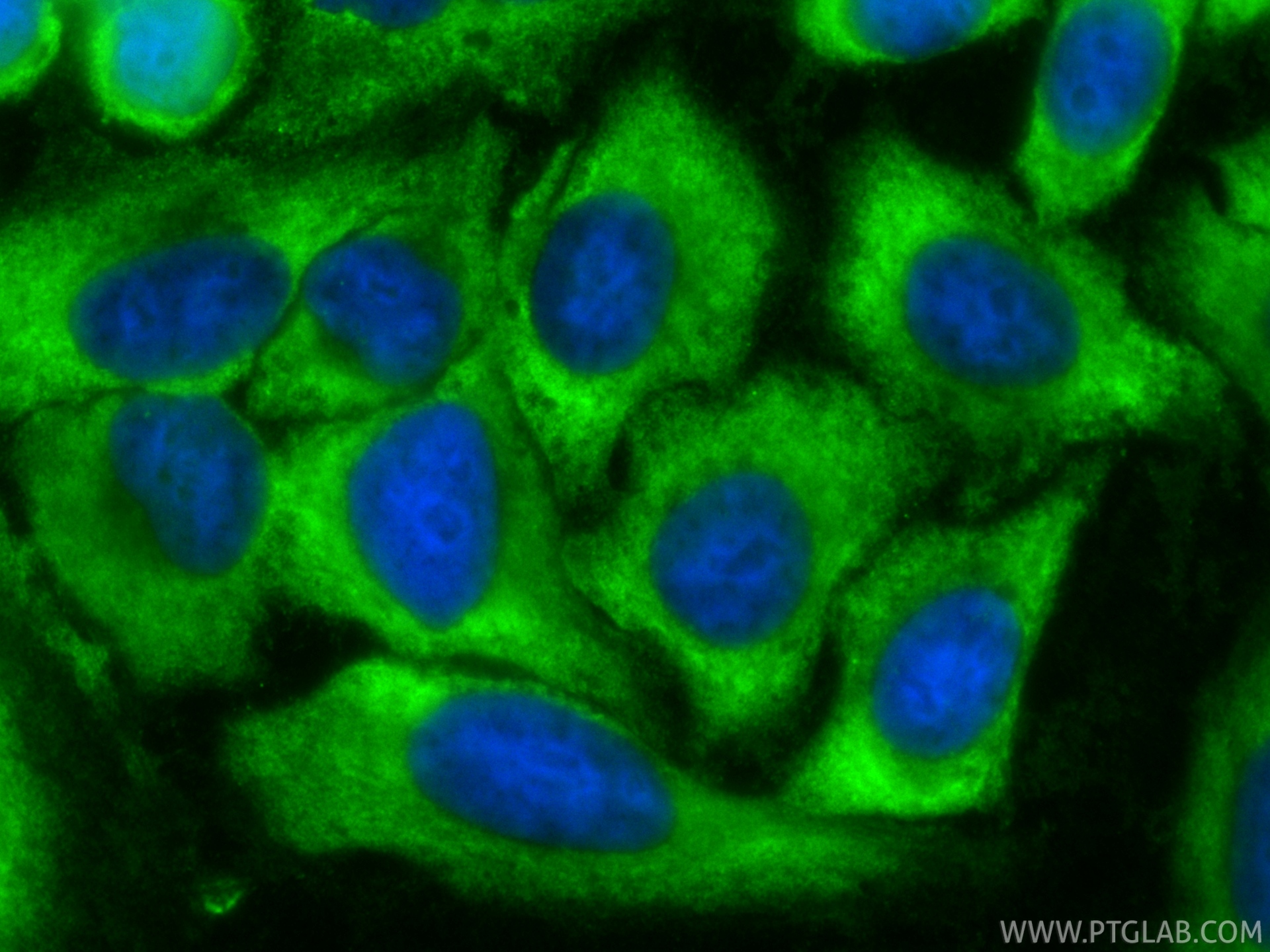 IF Staining of HepG2 using CL488-87386 IF Staining of HepG2 using CL488-87386