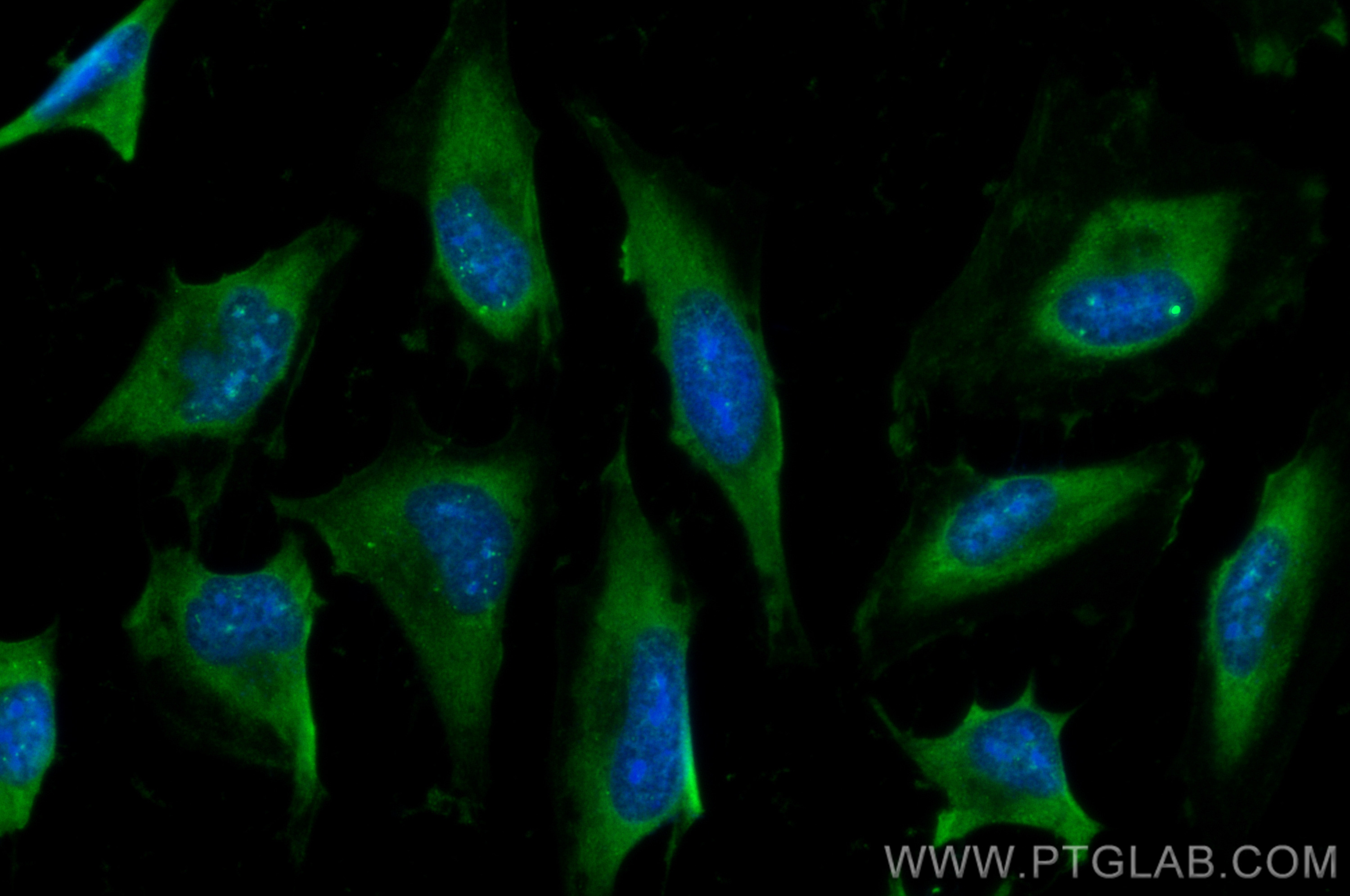 IF Staining of HeLa using CL488-21337