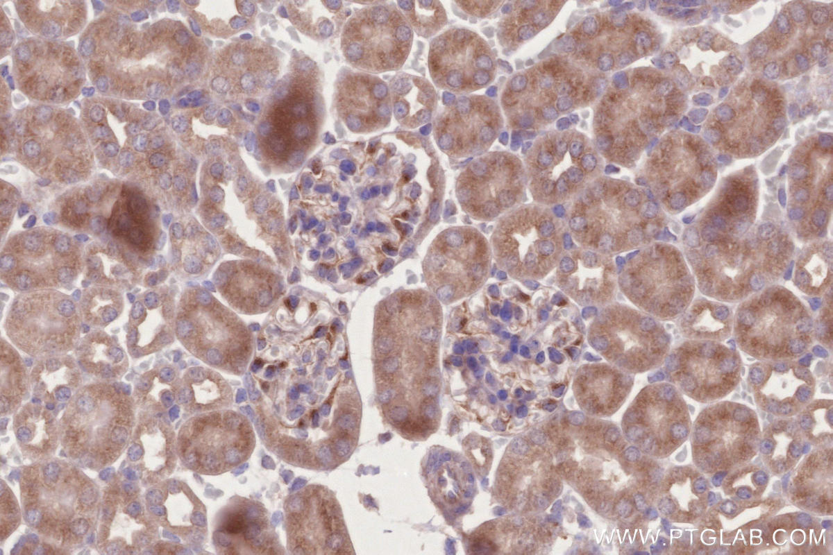 IHC staining of mouse kidney using 22157-1-AP IHC staining of mouse kidney using 22157-1-AP