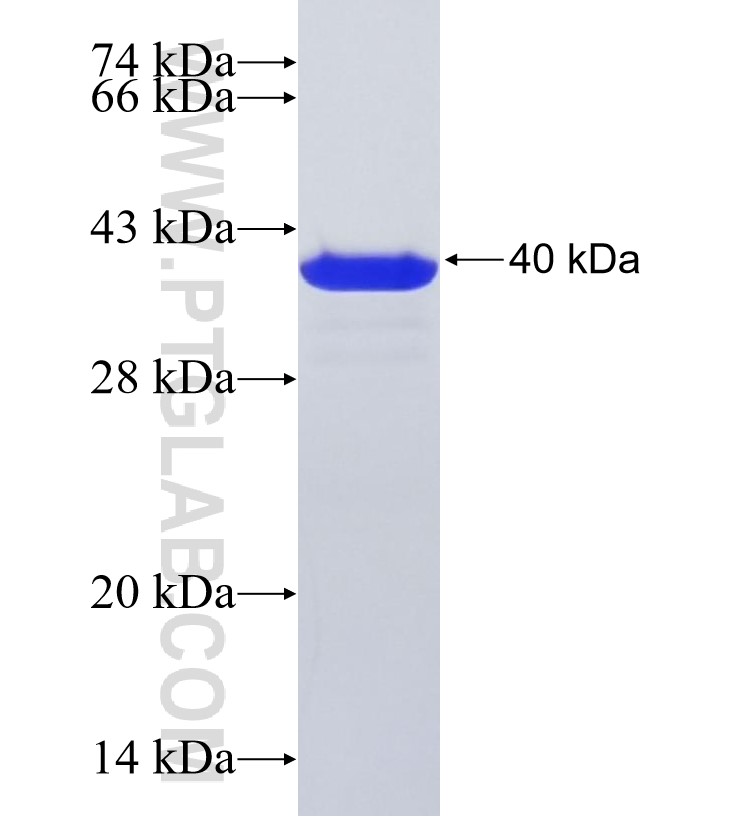 C3orf14 fusion protein Ag29153 SDS-PAGE C3orf14 fusion protein Ag29153 SDS-PAGE