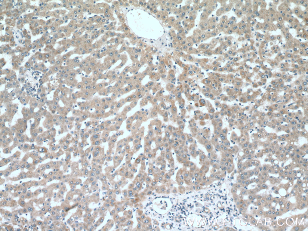 IHC staining of human liver using 20906-1-AP