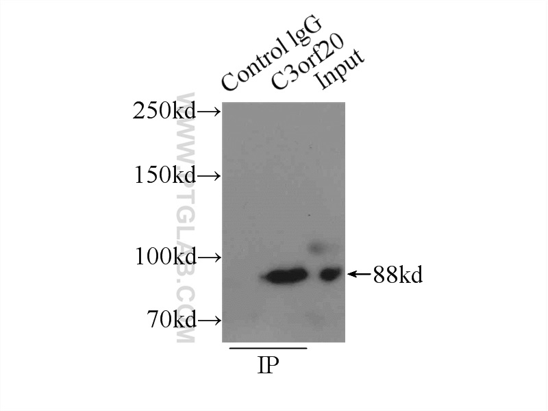 IP experiment of mouse brain using 20906-1-AP