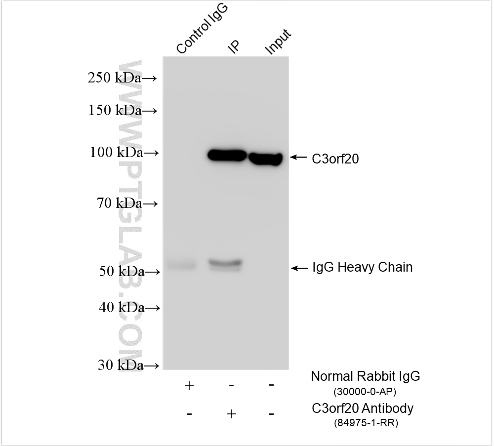 IP experiment of DU 145 using 84975-1-RR