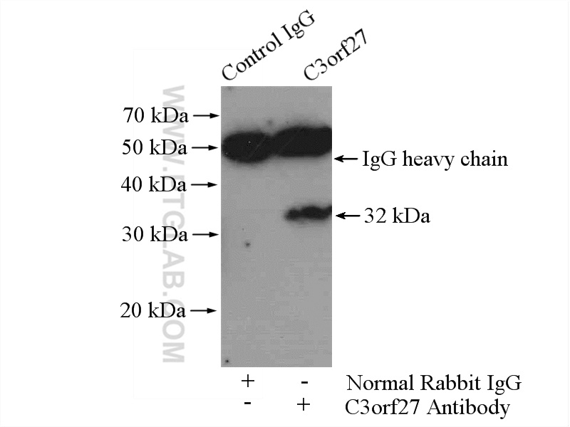 IP experiment of HeLa using 26114-1-AP