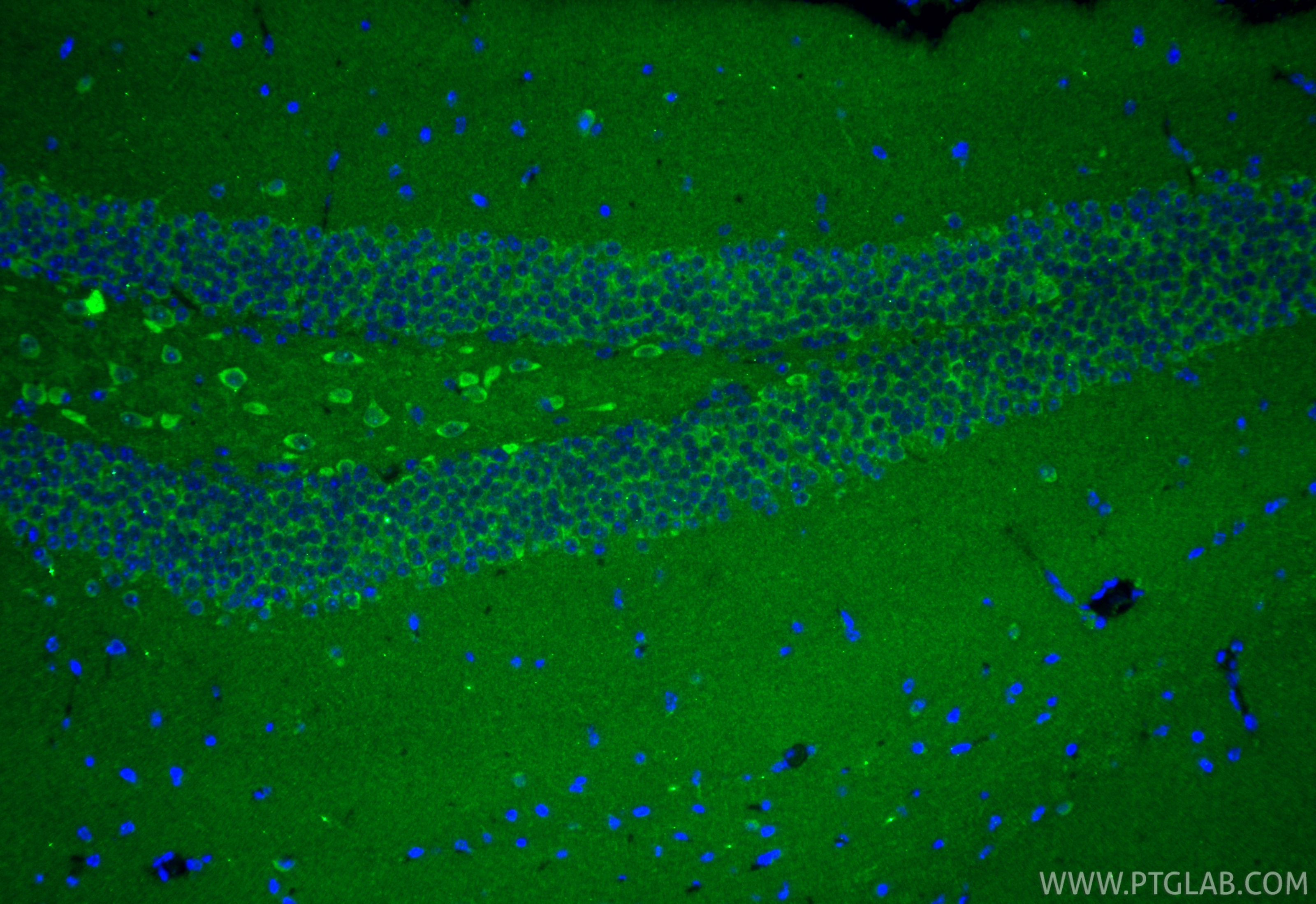 IF Staining of mouse brain using 28137-1-AP IF Staining of mouse brain using 28137-1-AP
