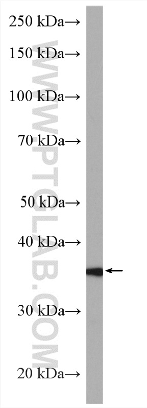 WB analysis of LNCaP using 28137-1-AP