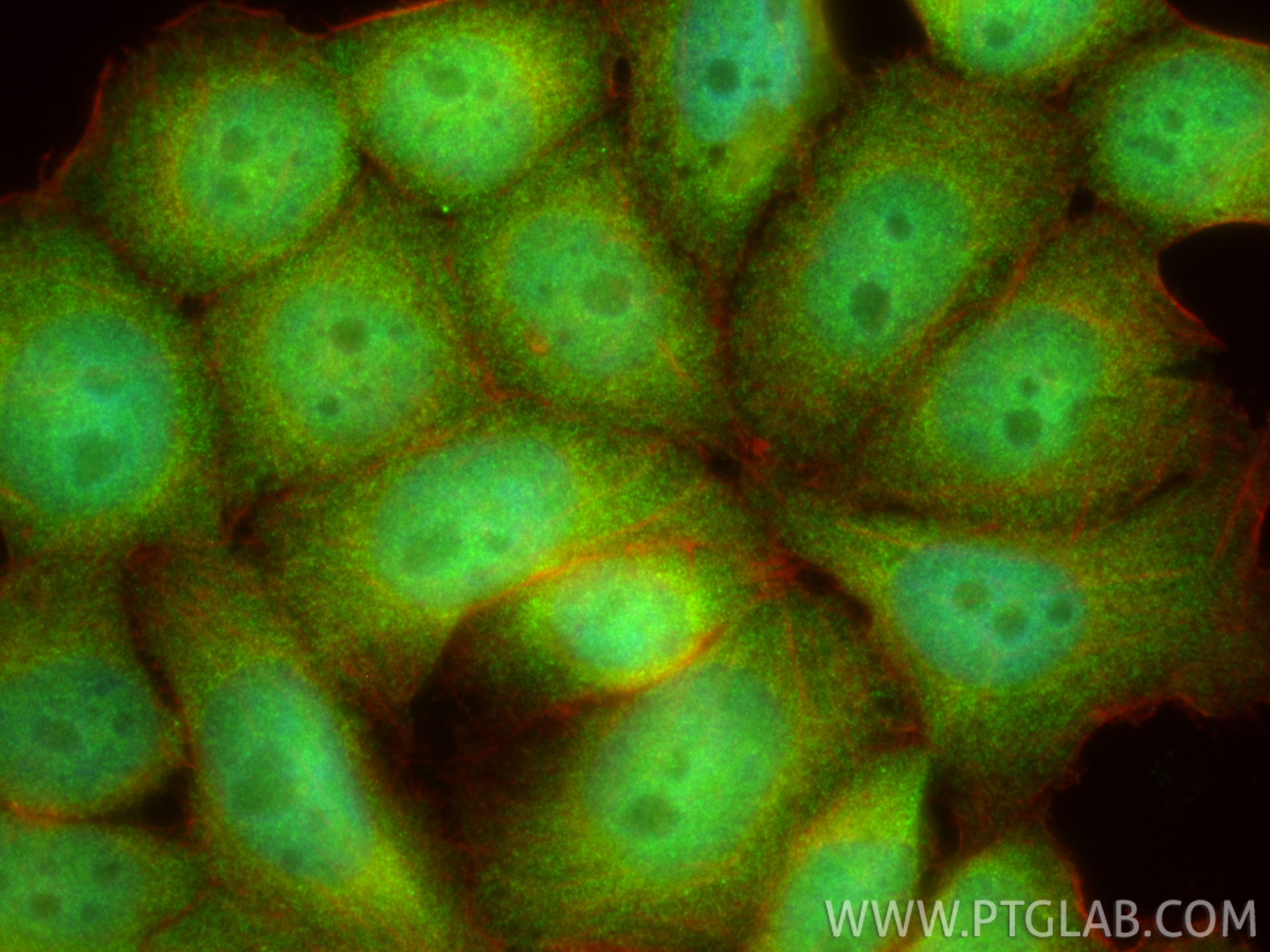 IF Staining of L02 using 25510-1-AP IF Staining of L02 using 25510-1-AP