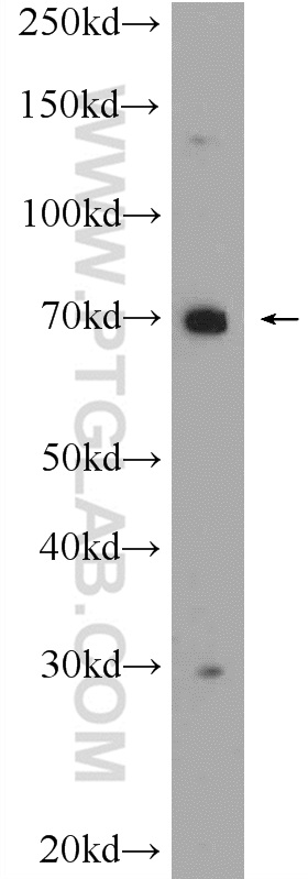 WB analysis of mouse skeletal muscle using 25575-1-AP