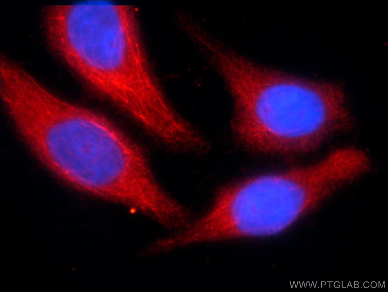 IF Staining of HepG2 using 25362-1-AP