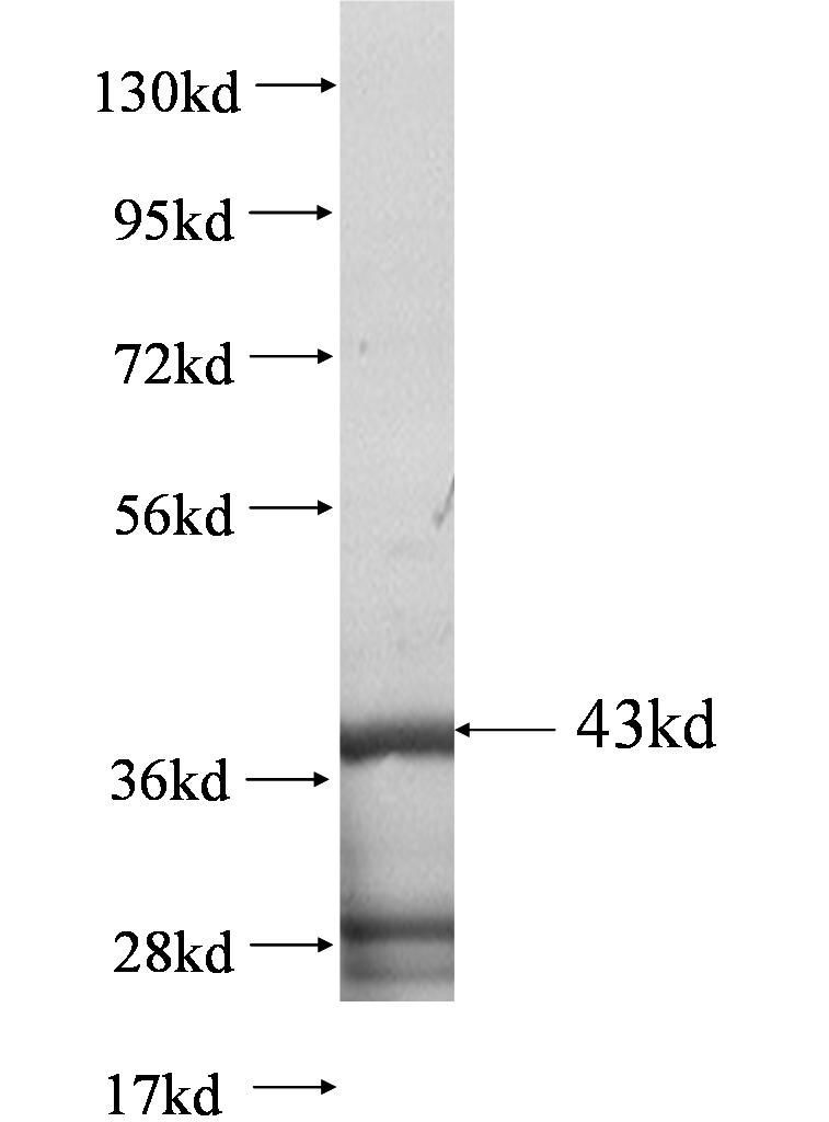 C3orf52 fusion protein Ag0618 SDS-PAGE C3orf52 fusion protein Ag0618 SDS-PAGE