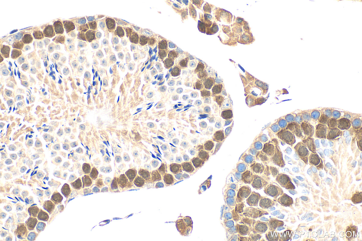 IHC staining of mouse testis using 32718-1-AP (same clone as 32718-1-PBS)