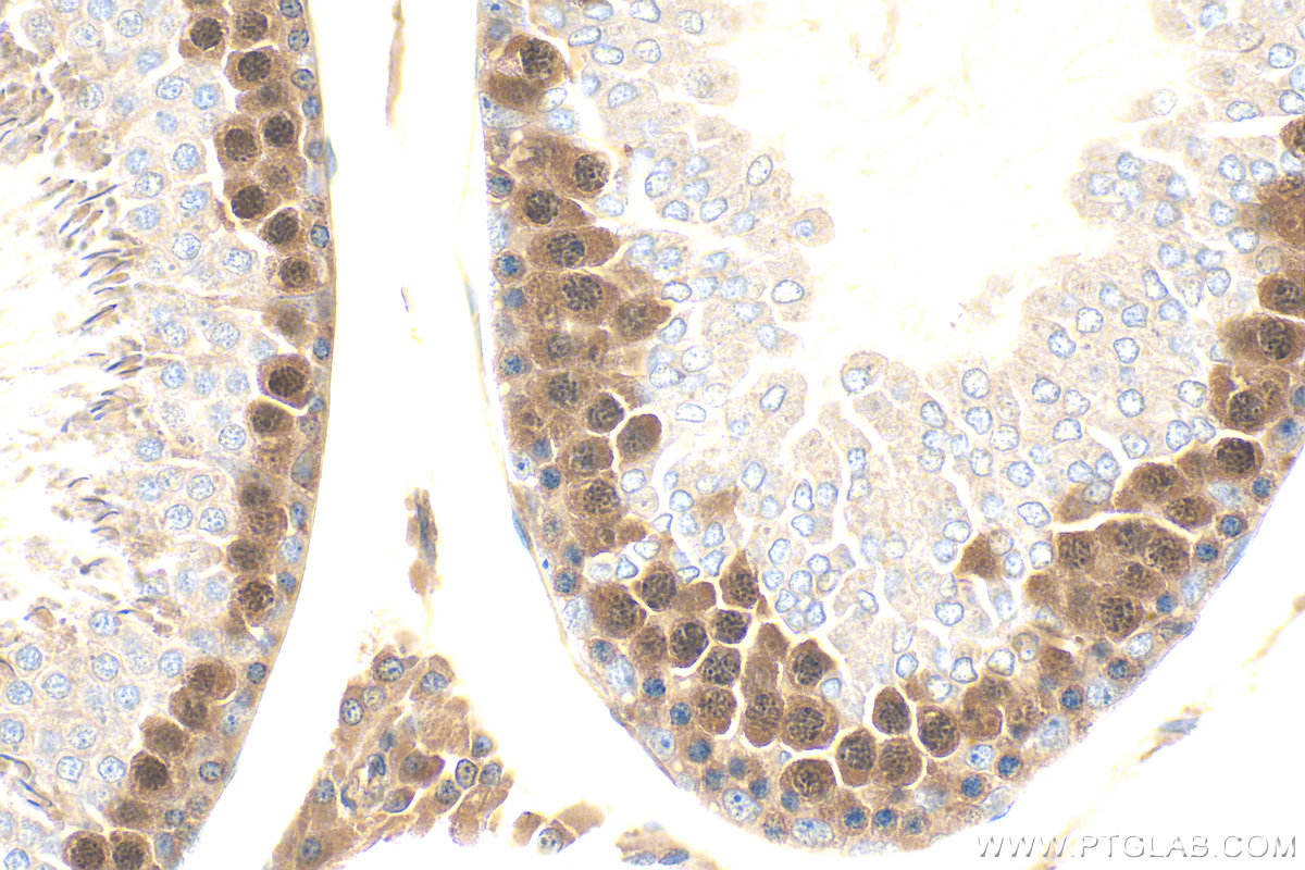 IHC staining of rat testis using 32718-1-AP (same clone as 32718-1-PBS)