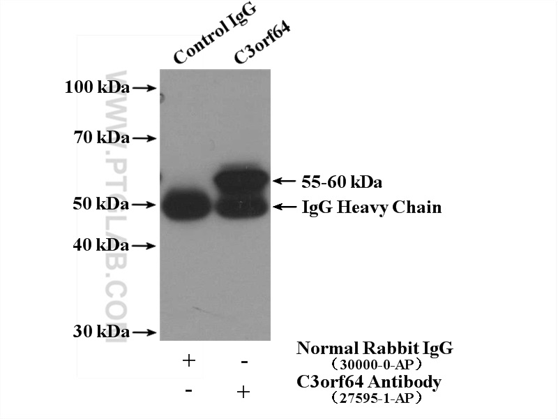 IP experiment of mouse brain using 27595-1-AP