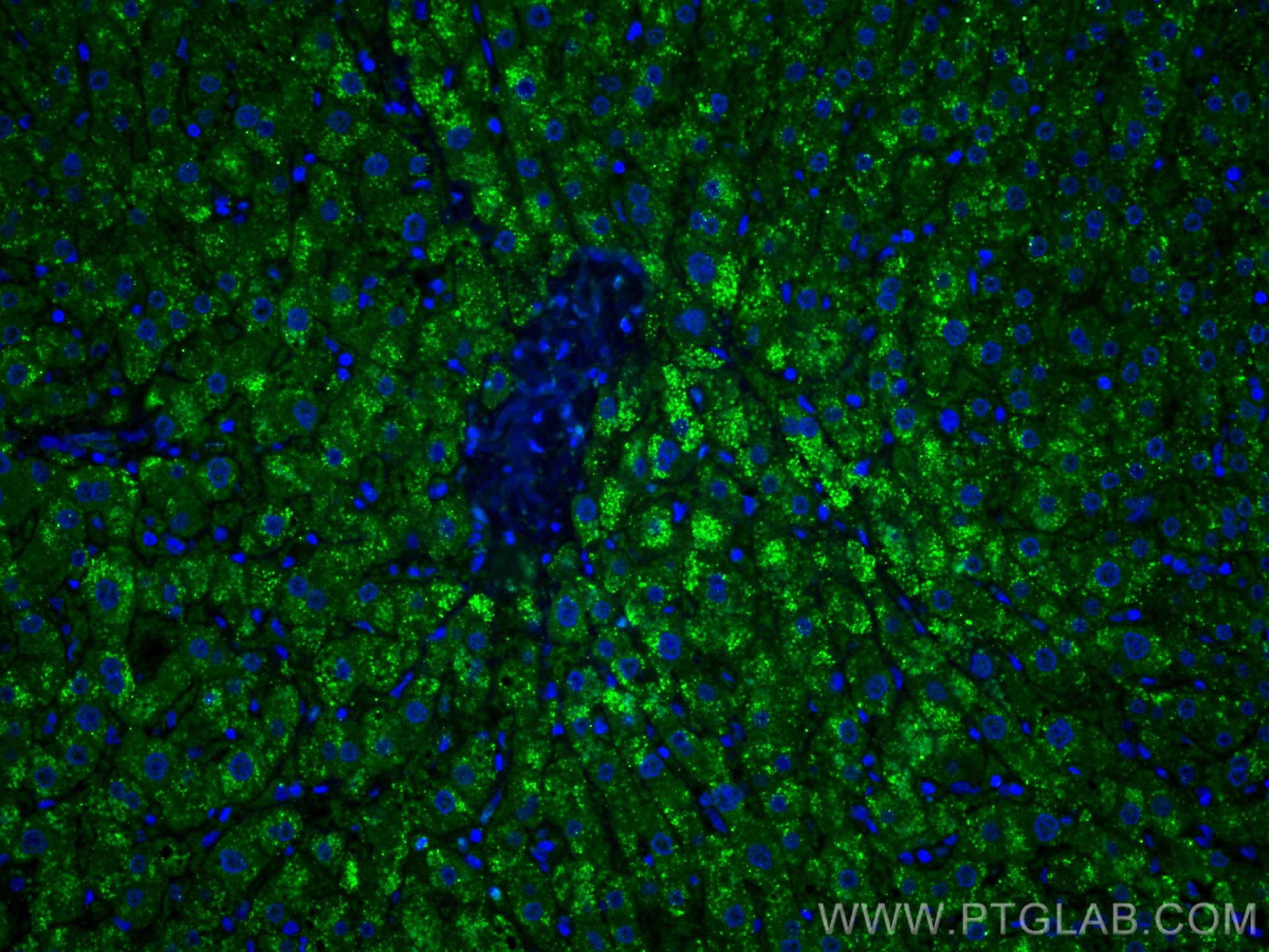 IF Staining of human liver using 66242-1-Ig (same clone as 66242-1-PBS)