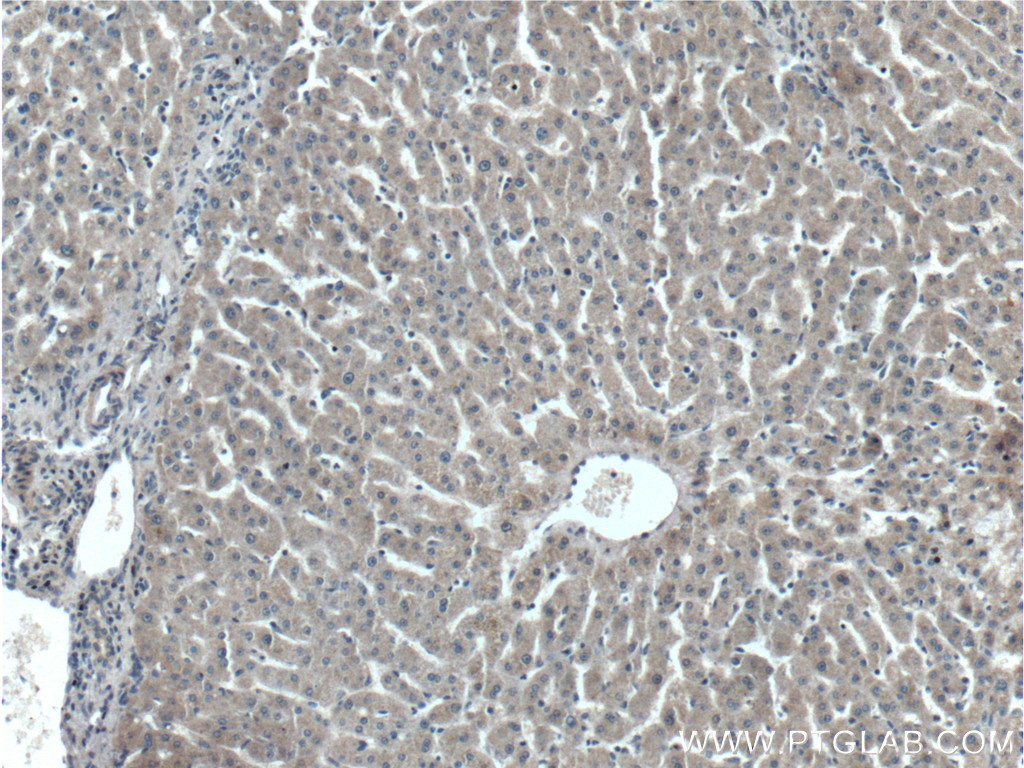 IHC staining of human liver using 66242-1-Ig (same clone as 66242-1-PBS)