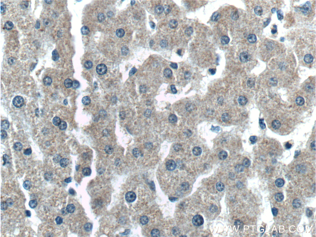 IHC staining of human liver using 66242-1-Ig (same clone as 66242-1-PBS)