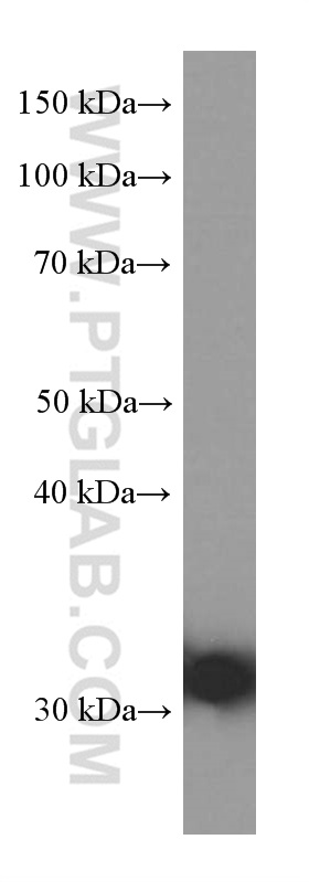 WB analysis of human plasma using 66242-1-Ig (same clone as 66242-1-PBS)
