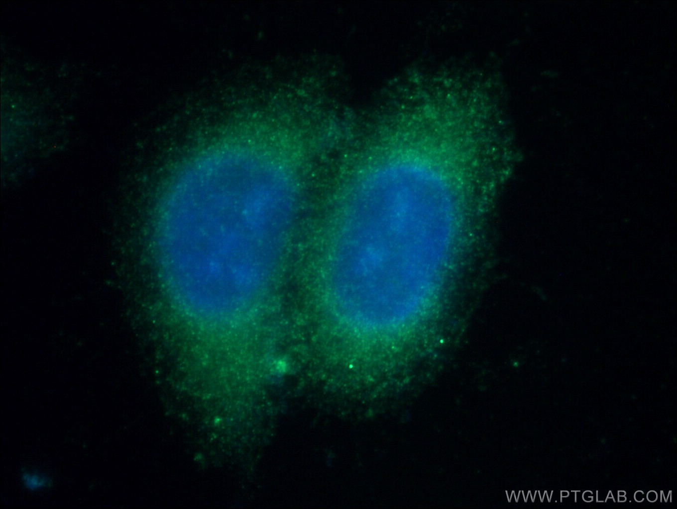 IF Staining of HepG2 using 15837-1-AP